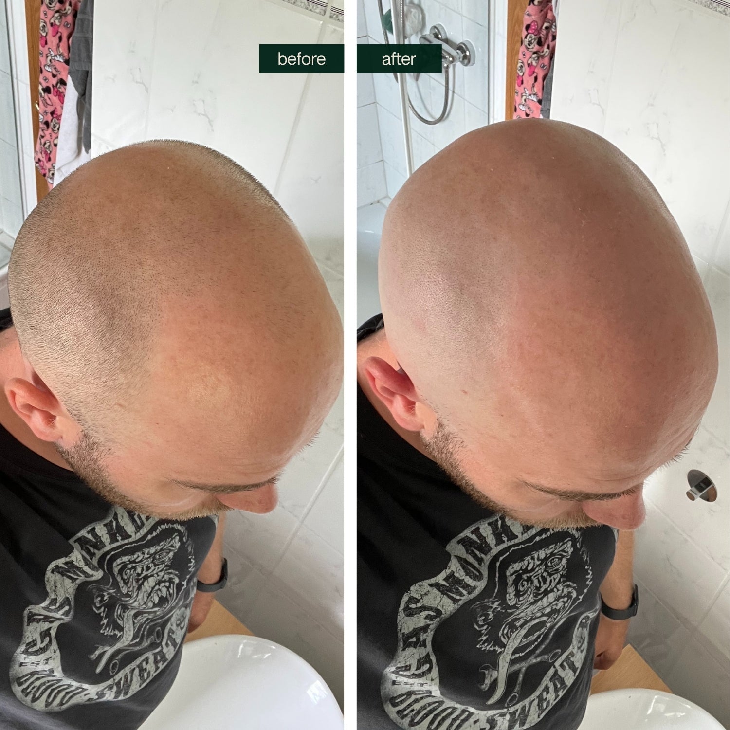 (30% di sconto) Tagliacapelli FK-8750 senza fili 6D per testa calva – Rasoio rotante da uomo impermeabile con lama magnetica ricaricabile e display LCD.